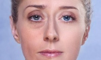 Айс100 (EyeS100), 5 мл